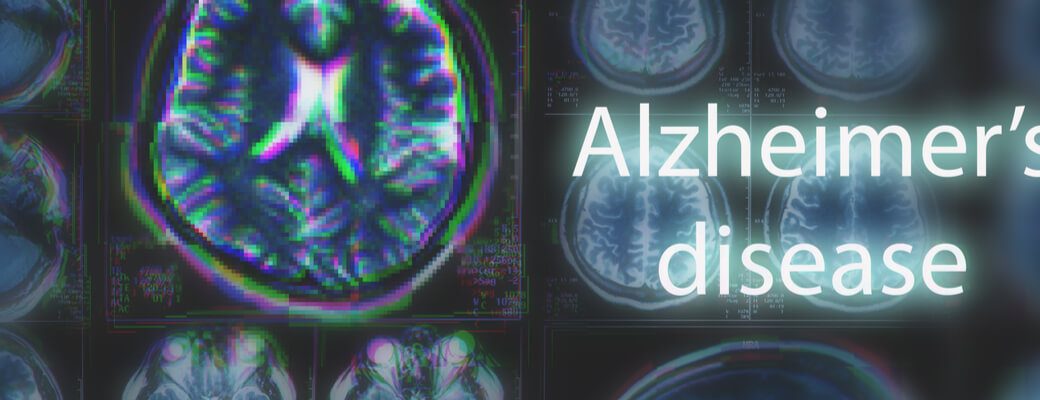 Pain in a Senior With Late-Stage Alzheimers