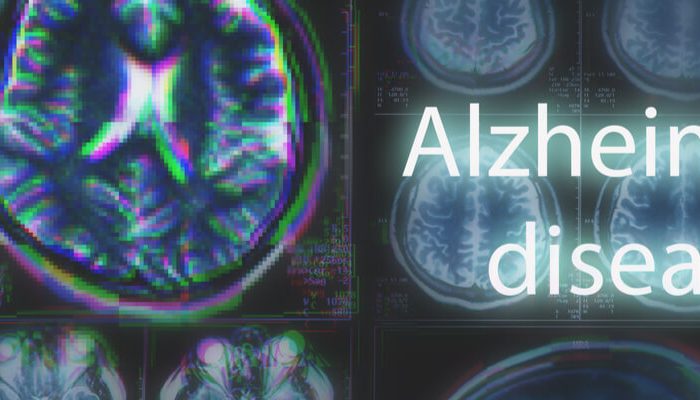 Pain in a Senior With Late-Stage Alzheimers
